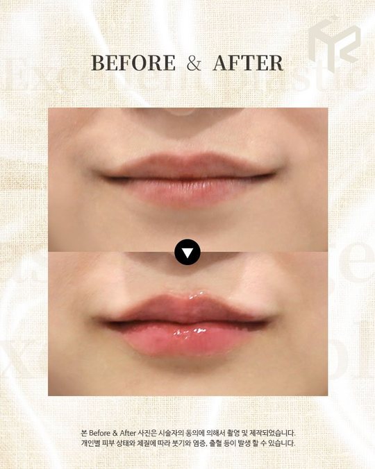 인스타그램 — BEFORE & AFTER