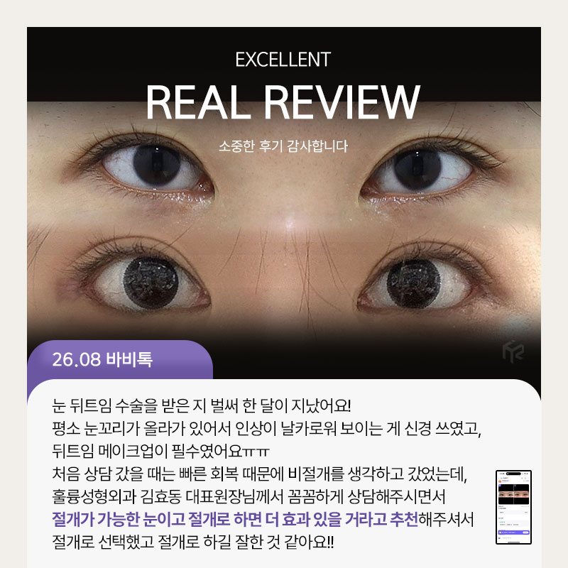 REAL REVIEW — 26.08 바비톡 후기 카드