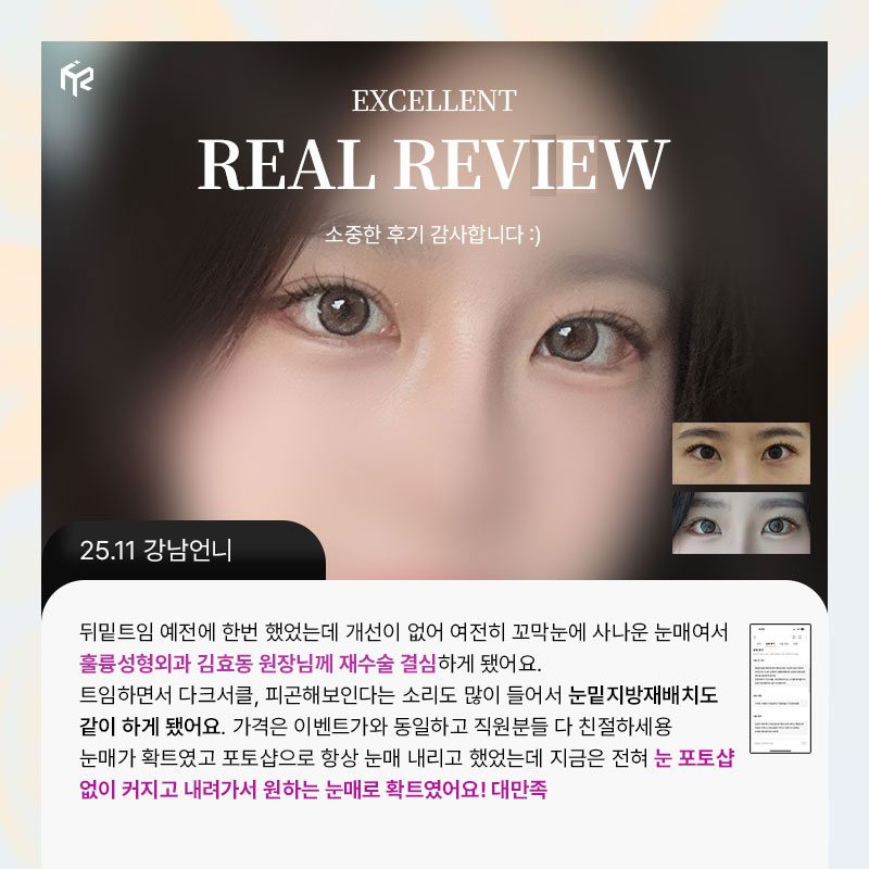 REAL REVIEW — 25.11 강남언니 후기 카드