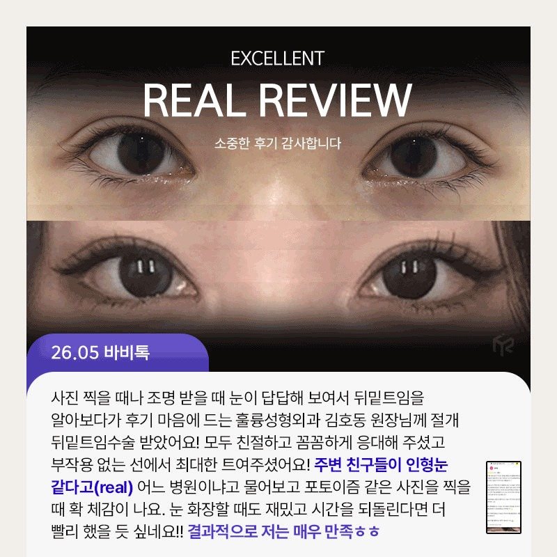 REAL REVIEW — 26.05 바비톡 후기 카드(움직이는 그림 2번째 장)