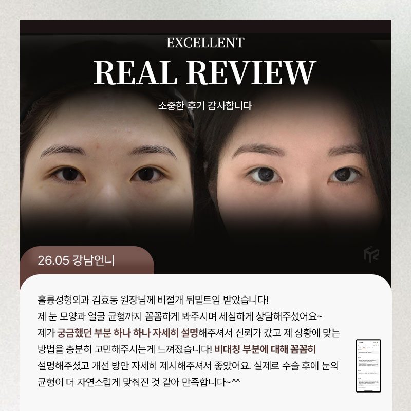 REAL REVIEW — 26.05 강남언니 후기 카드