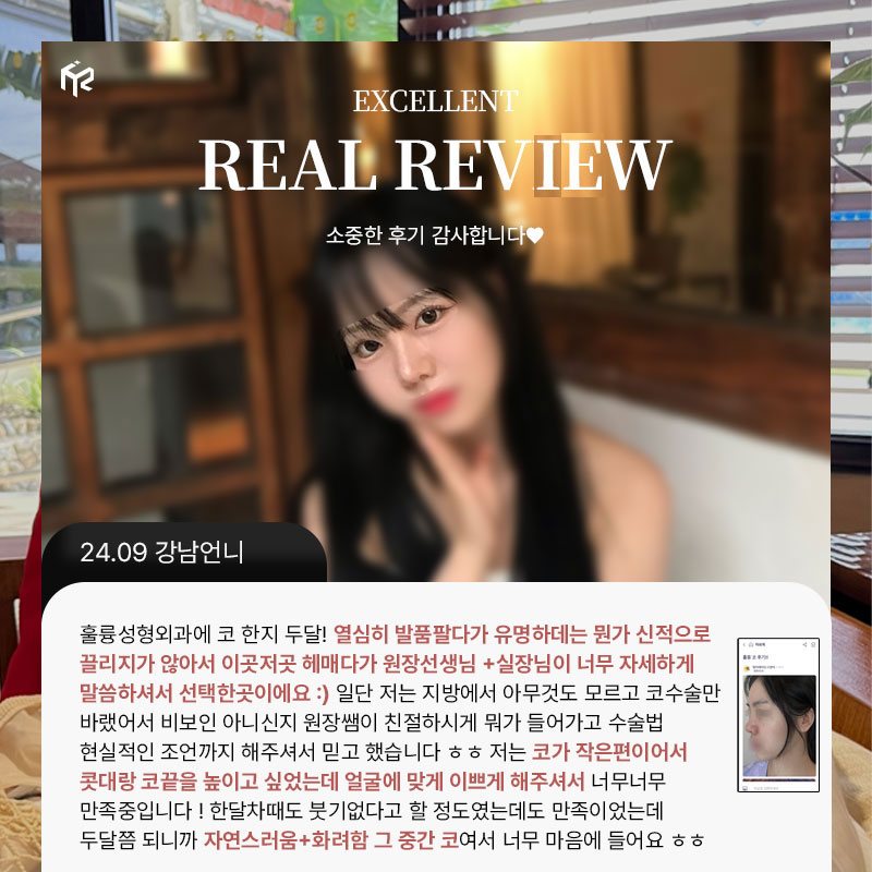 REAL REVIEW — 24.09 강남언니 후기 카드