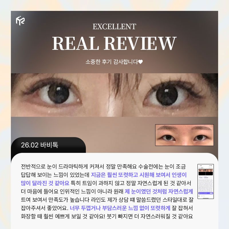 REAL REVIEW — 26.02 바비톡 후기 카드