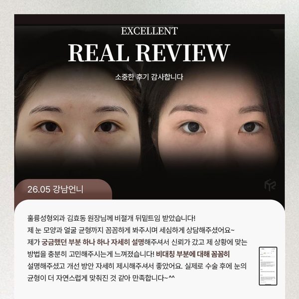 REAL REVIEW — 26.05 강남언니 후기 카드